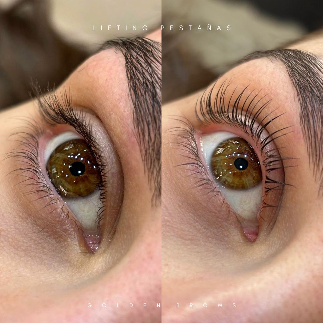 Lifting de Pestañas