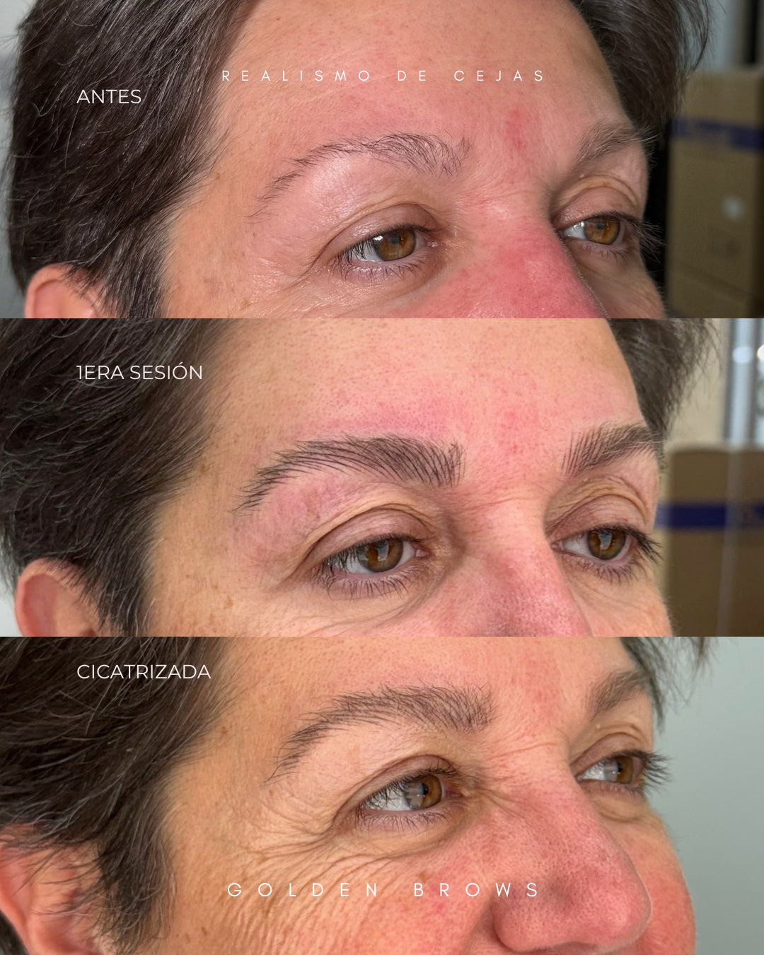 Realismo de Cejas