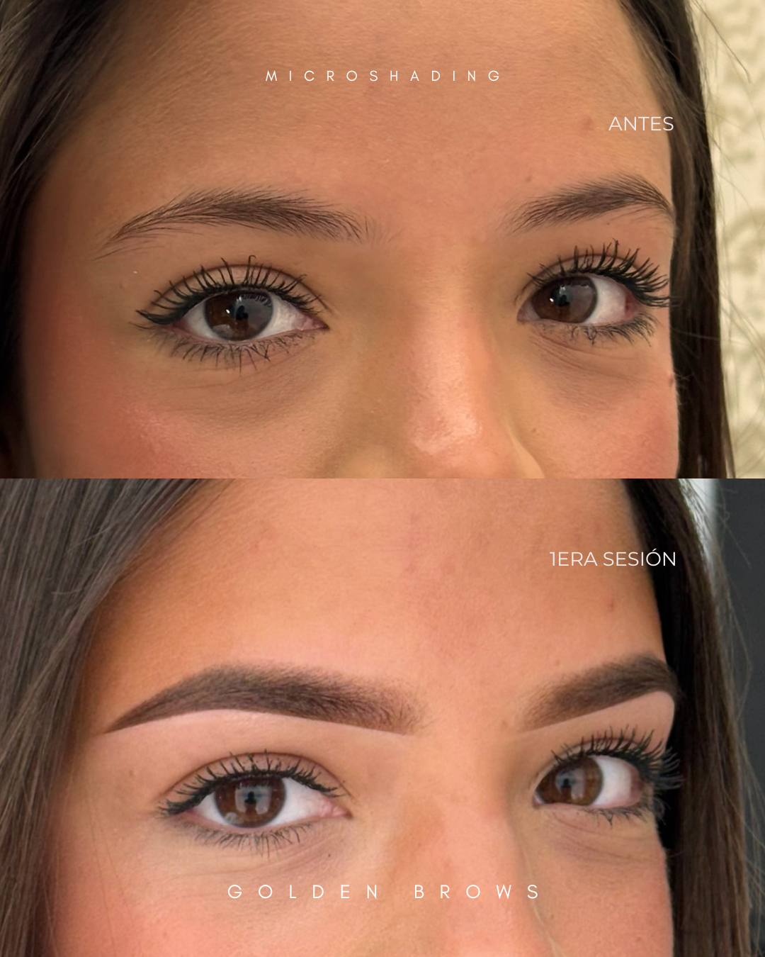 Microshading
