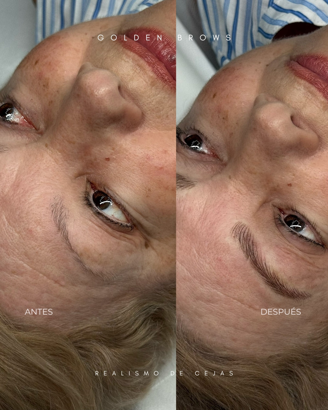 Realismo de Cejas