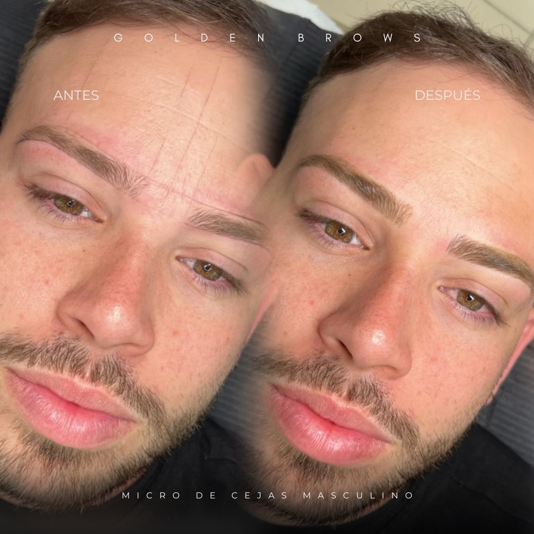 Micro de Cejas (MIXTO)