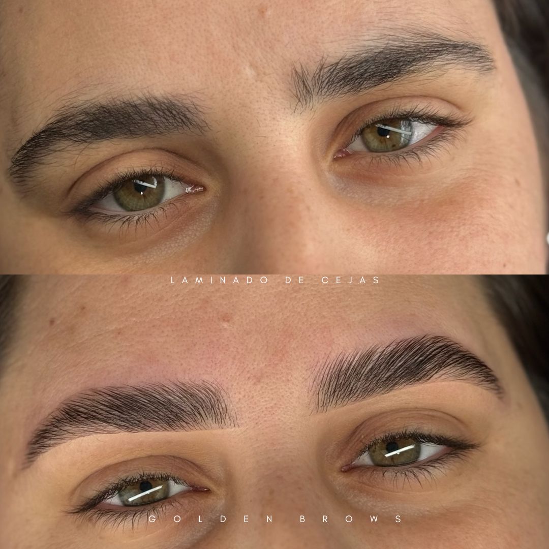 Lift Brows